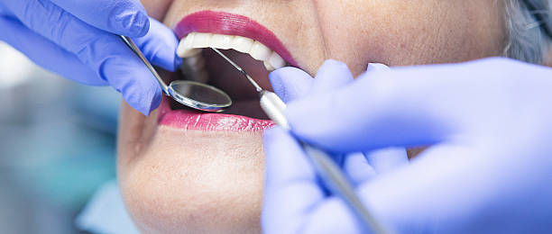 Best Emergency Dentist for Lost Fillings or Crowns in Grafton, WI
